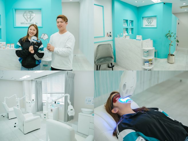 セルフホワイトニング専門店「ホワイトニングカフェ名古屋栄店」体験レポート。憧れの白い歯を手に入れよう！